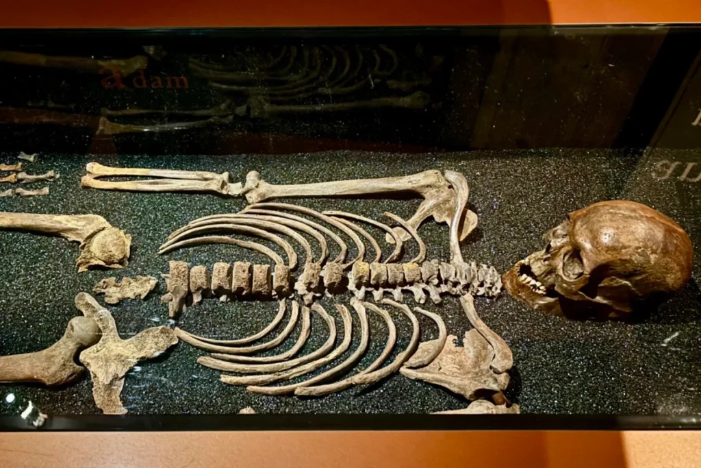 Human skeletal remains displayed in an exhibition at Stockholm's Vasa Museum